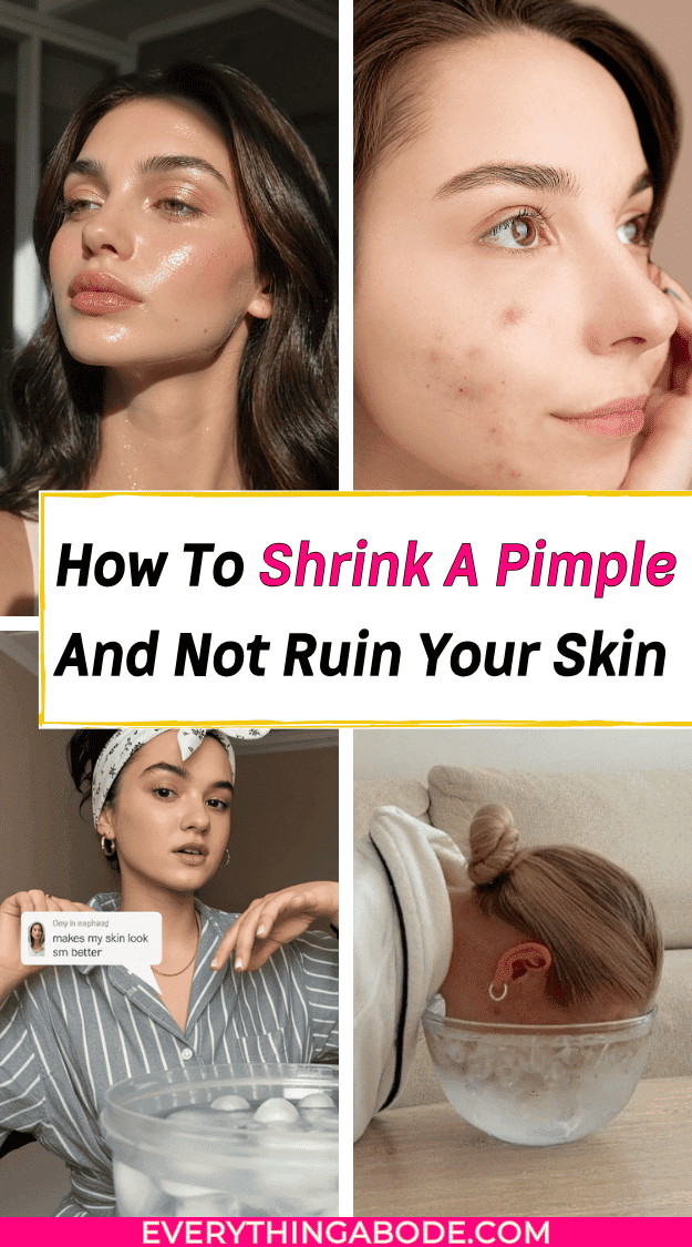 How To Get Rid Of Pimples Overnight