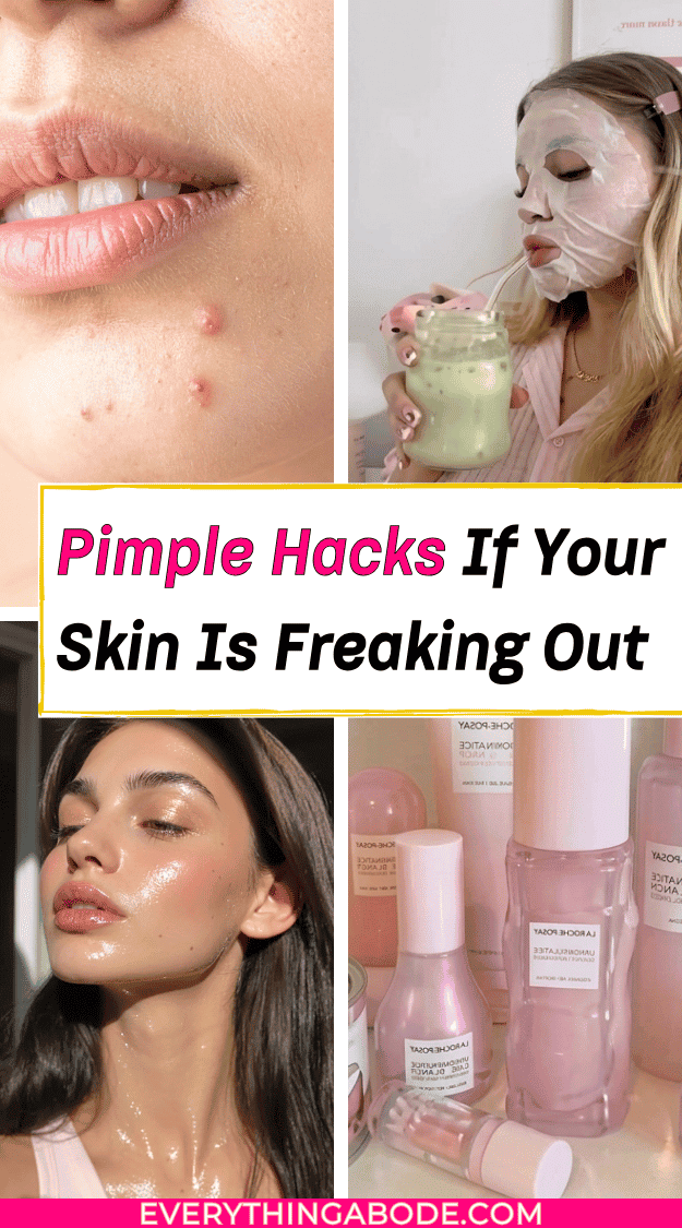How To Get Rid Of Pimples Overnight