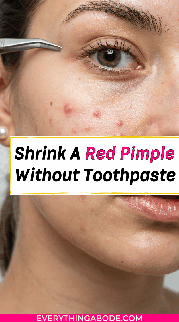 how to shrink a pimple without toothpaste