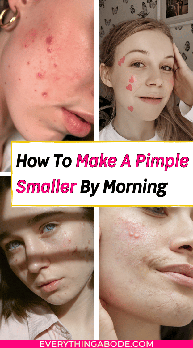 How to shrink a pimple overnight without toothpaste