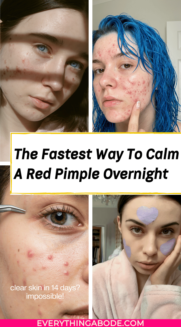 How to shrink a pimple overnight without toothpaste