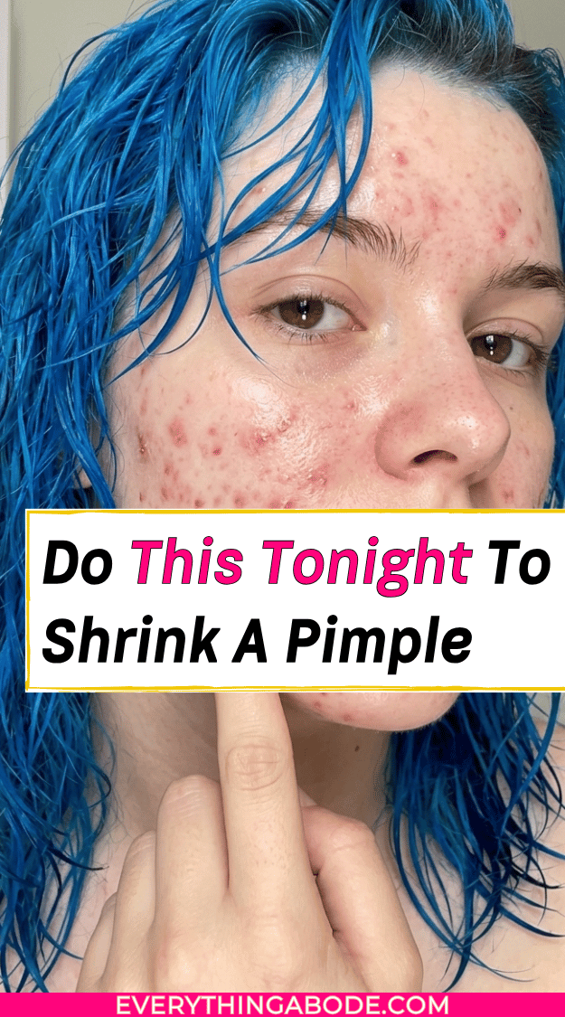 how to shrink a pimple without toothpaste