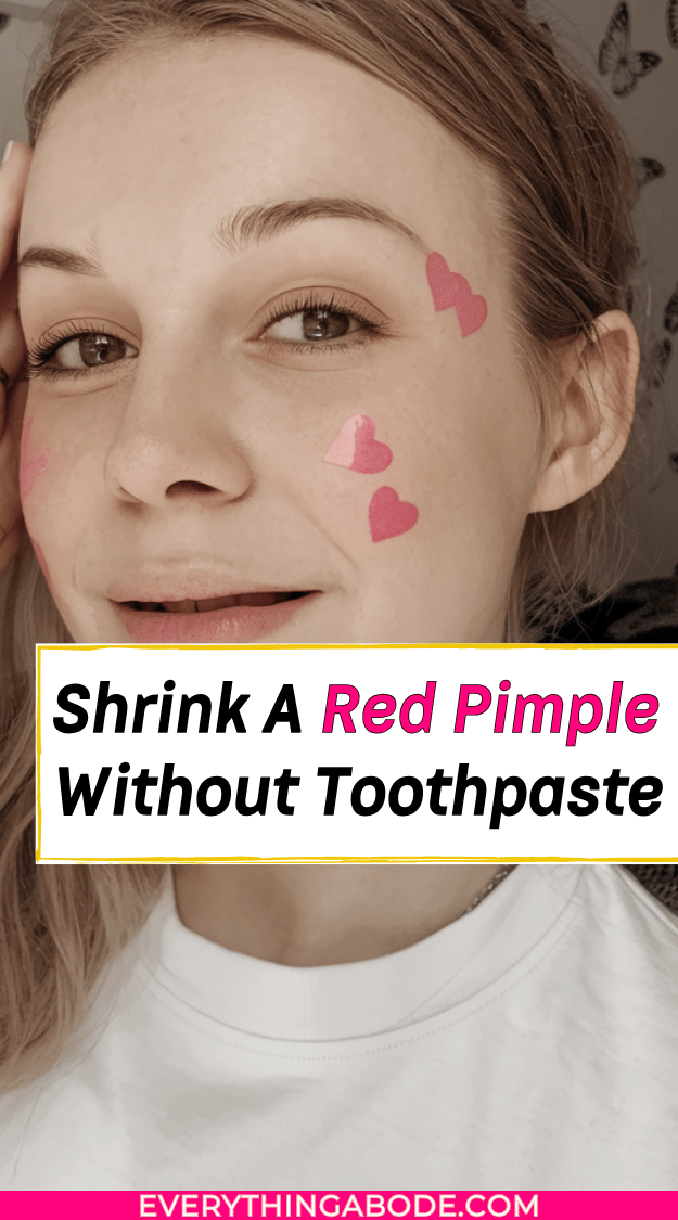 how to shrink a pimple without toothpaste